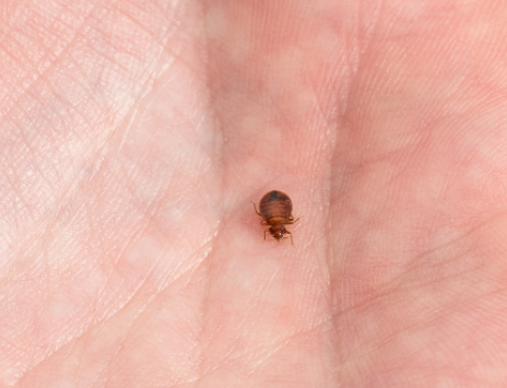 bed bug in hand